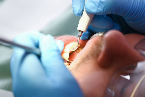 Best Pediatric Emergency Dentist in Union, MO